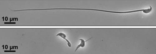 マウスの精子の顕微鏡画像。タンパク質「CFAP91」を作る遺伝子を欠損させた精子(下)は、べん毛の形成がうまくいかず泳げなくなった